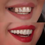 راهنمای جامع اصلاح طرح لبخند: رسیدن به لبخند رویایی با دندانپزشکی بهبد